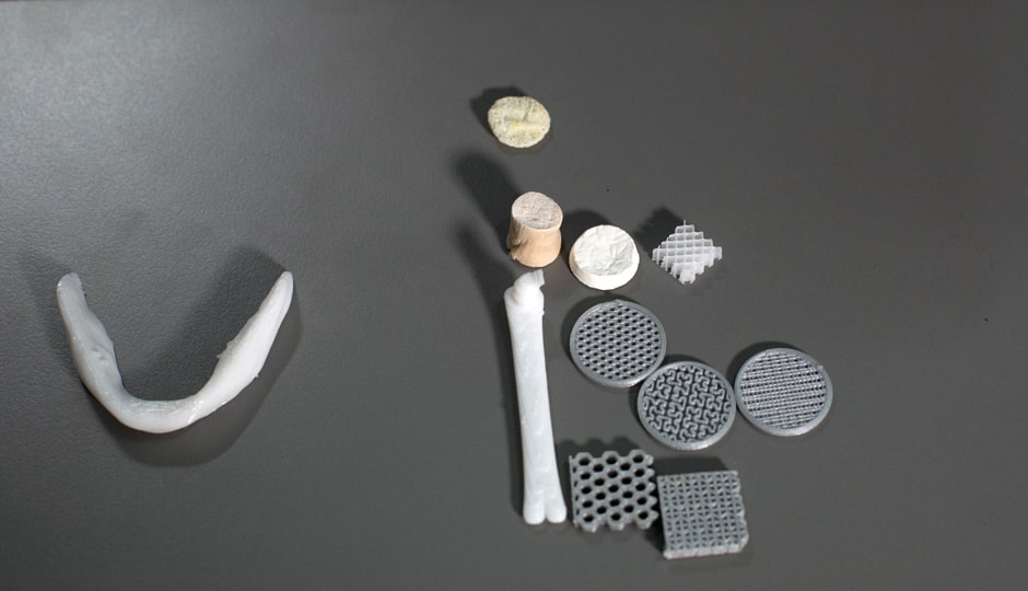 bone-graft